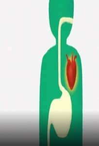 por qué no funcionan las dietas. Serie documental de Netflix En pocas palabras